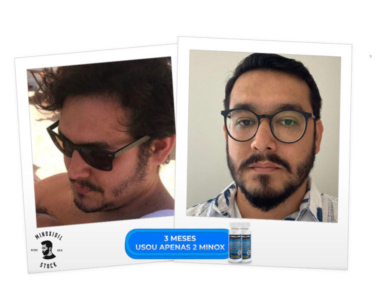 3 meses 2 minoxx