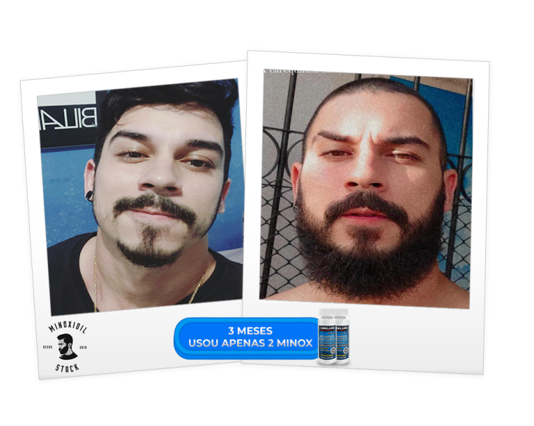 3 meses 2 minoxxxx