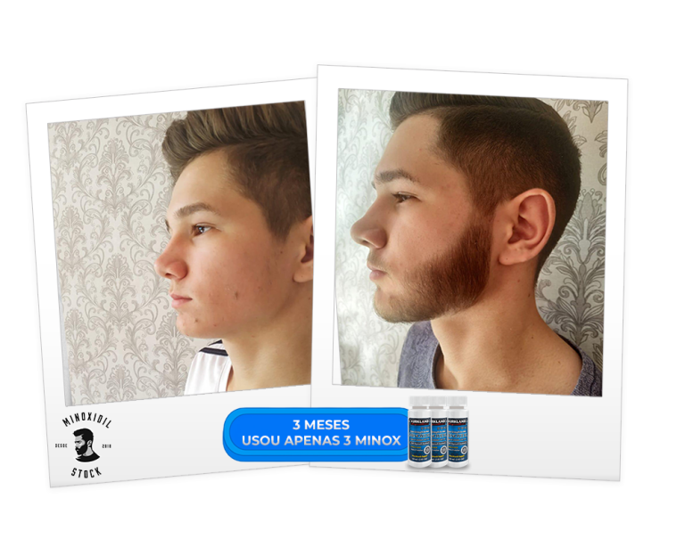 3 meses 3 minox