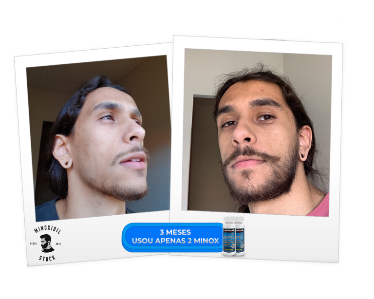 3 meses e 2 minox