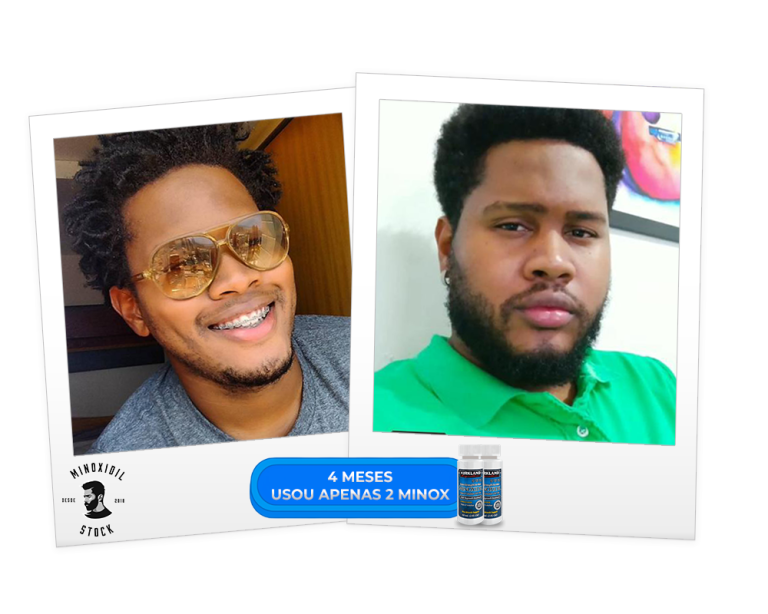 4 meses 2 minox