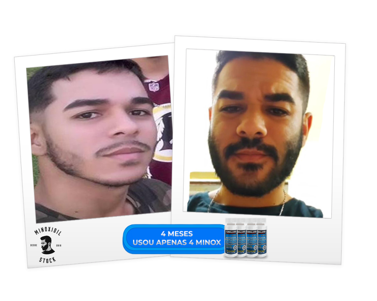 4 meses 4 minoxxs