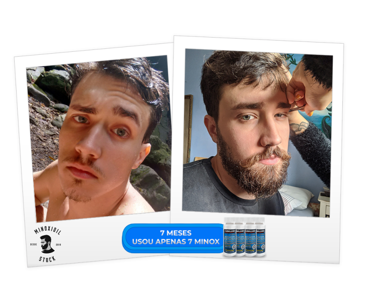 7 meses e 7 minox